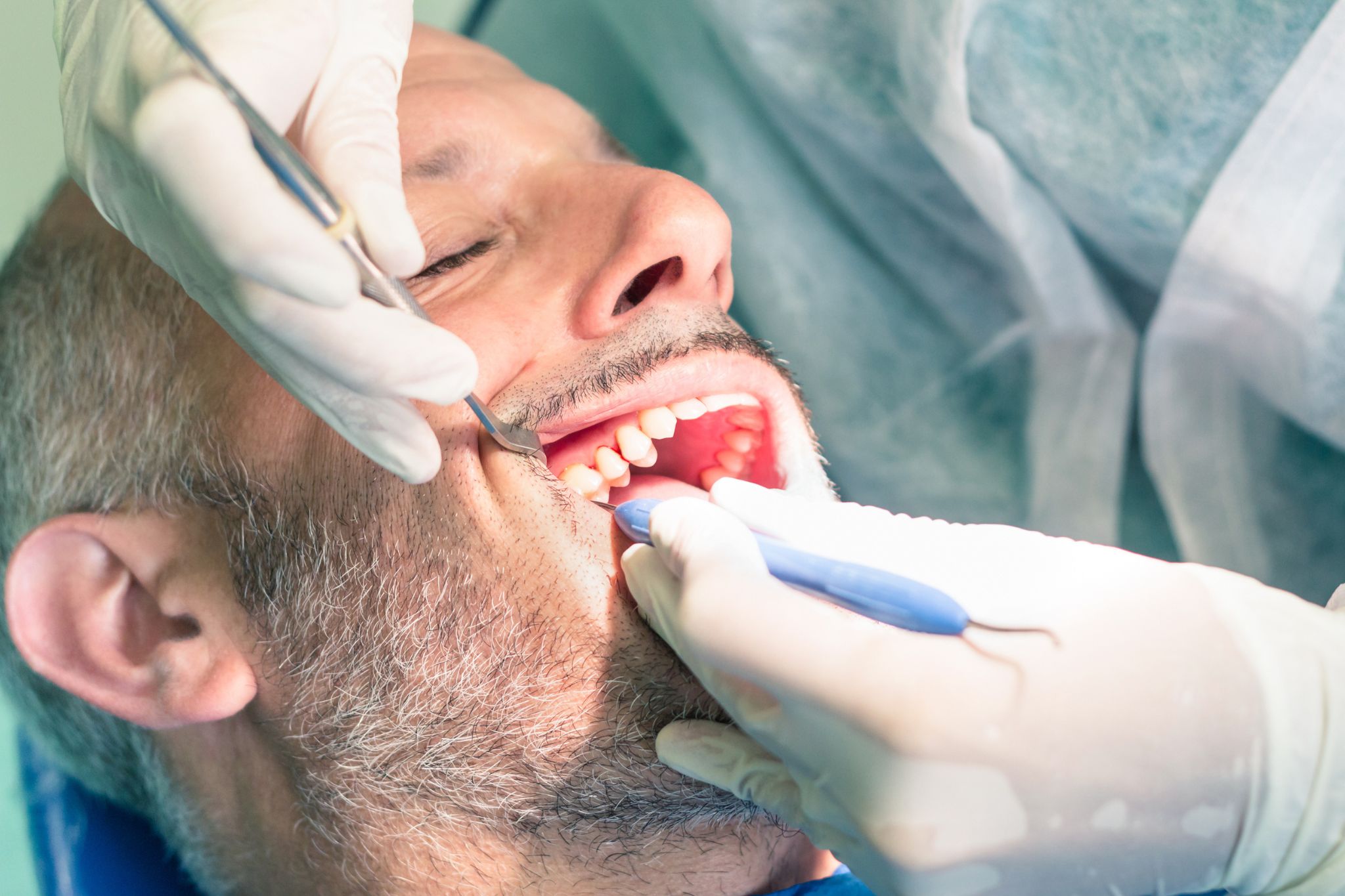 quanto costa devitalizzare un dente - Dentisti Croazia
